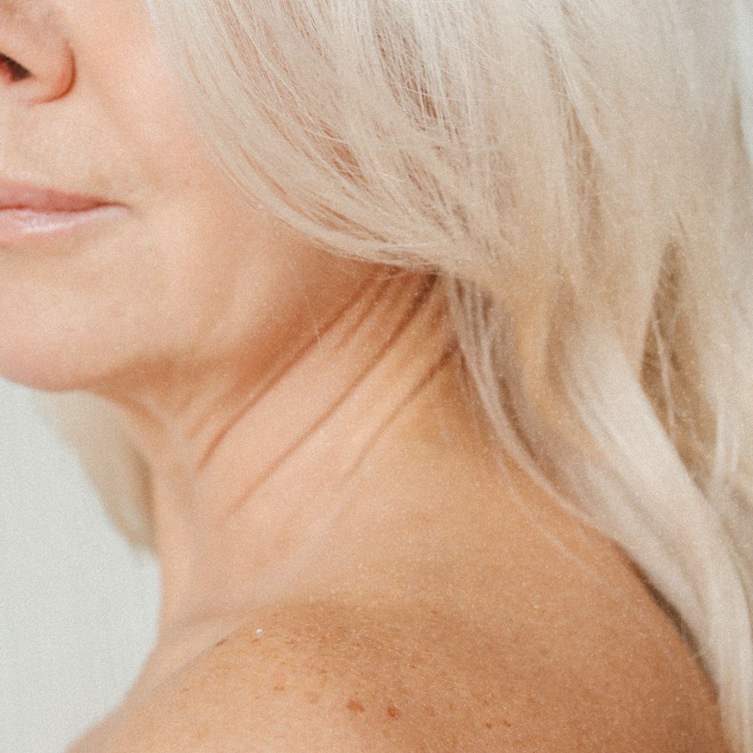 Vad är pigmenteringar?