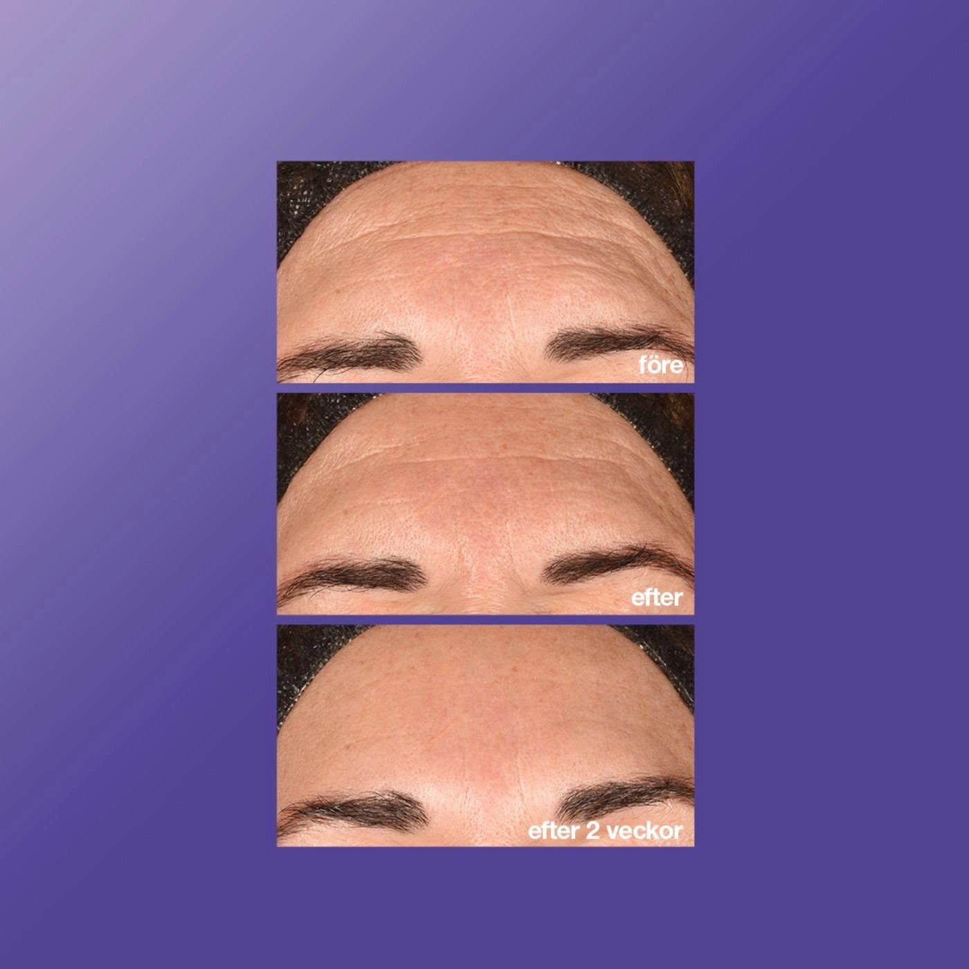 Dermalogica Phyto Nature E2