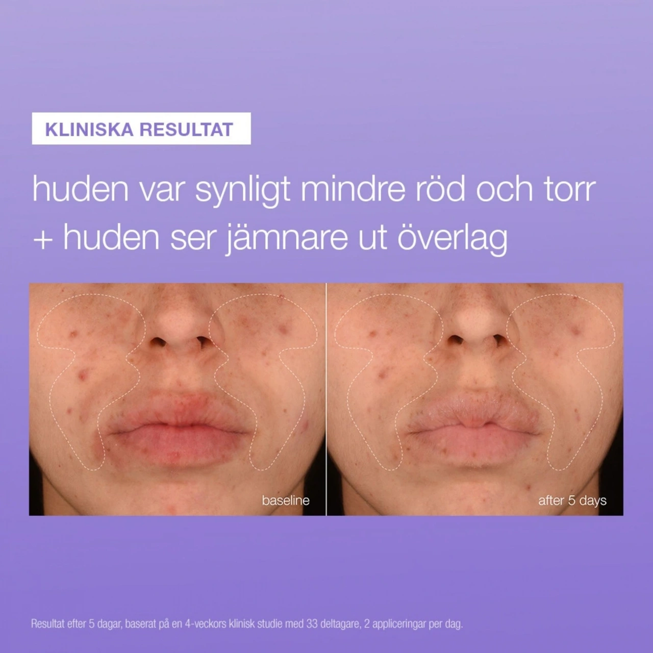 Dermalogica Stabilizing Repair Serum