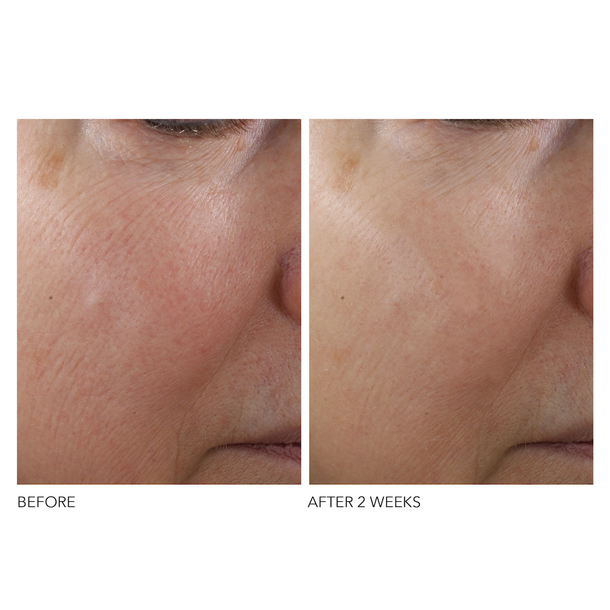 Dr Dennis Gross Advanced Retinol + Ferulic Texture Renewal Serum