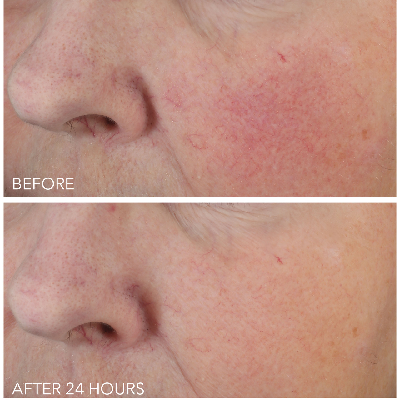 Dr Dennis Gross Vitamin C+ Lactic Dewy Deep Cream