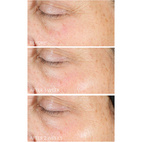 Dr Dennis Gross Vitamin C + Lactic Firm & Bright Eye Treatment